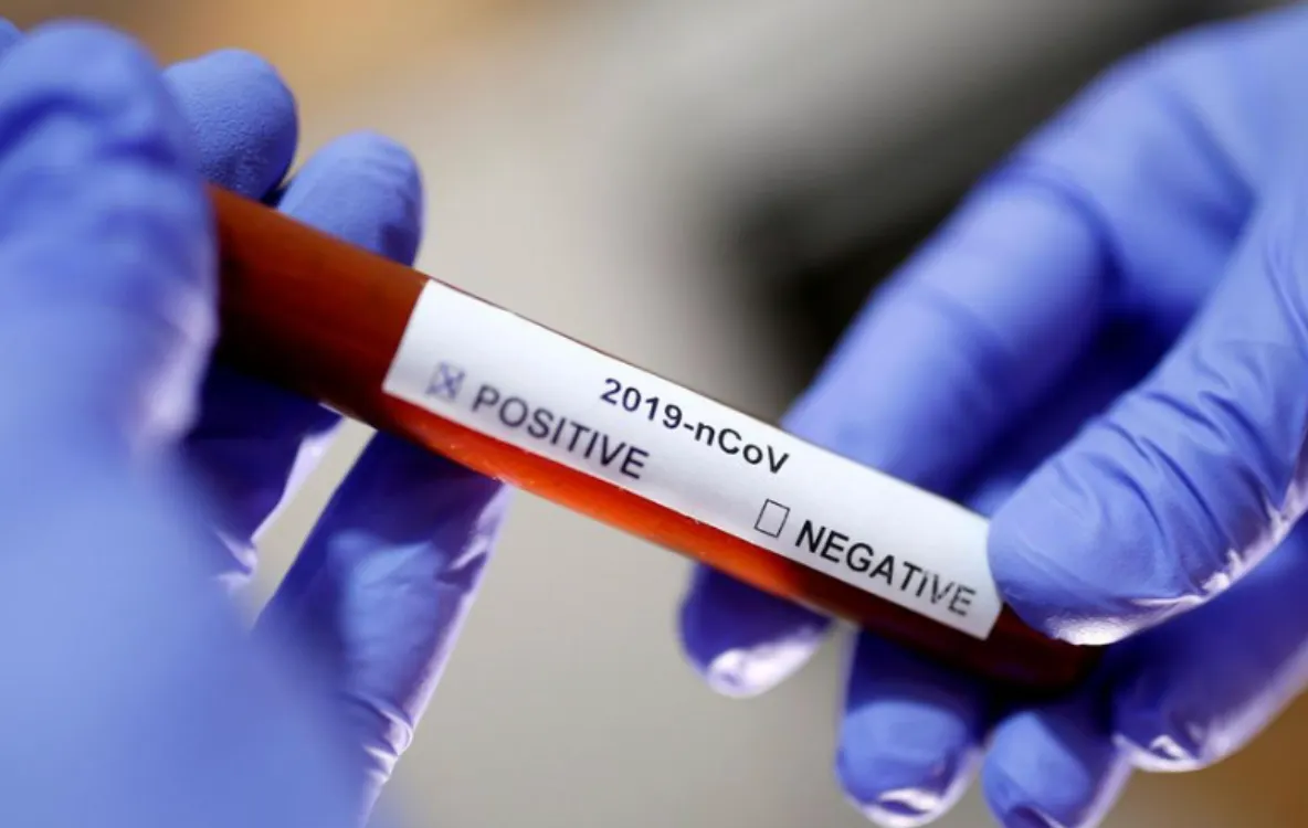 50.000 de teste ajung în unitățile sanitare săptămâna aceasta