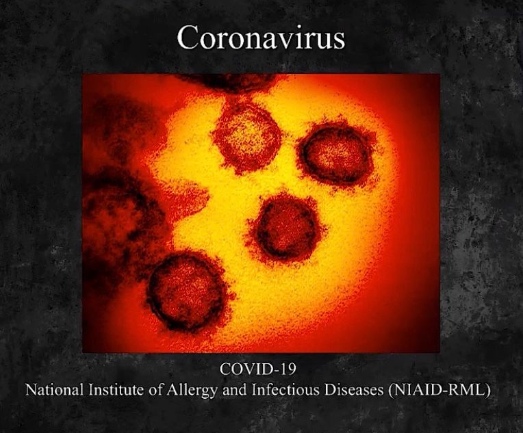 56DDBA5D-2CFB-4EF8-A7FA-7EF82E320360